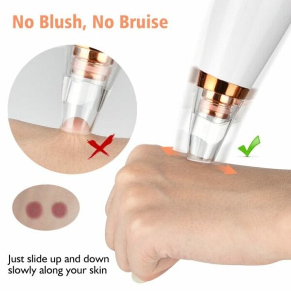 Electric Blackhead Remover Cleaner Pore Vacuum Nose Black Spots Extractor Acne Cleanser Tool Skin Care Facial Against Black Dot